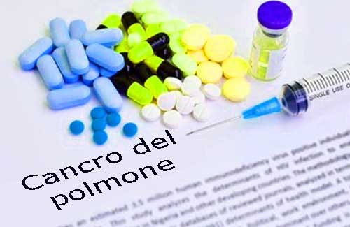 Alectinib in adiuvante nel NSCLC